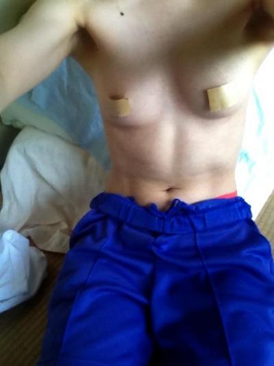 ガムテープをブラ代わりに使うBカップの現役女子学生！！のサムネイル画像