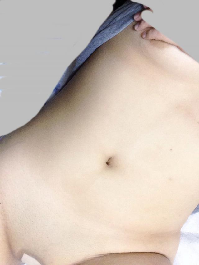 下腹ぽっこりのパイパンっ娘が絆創膏で乳首とマンコを隠して自撮り！！のサムネイル
